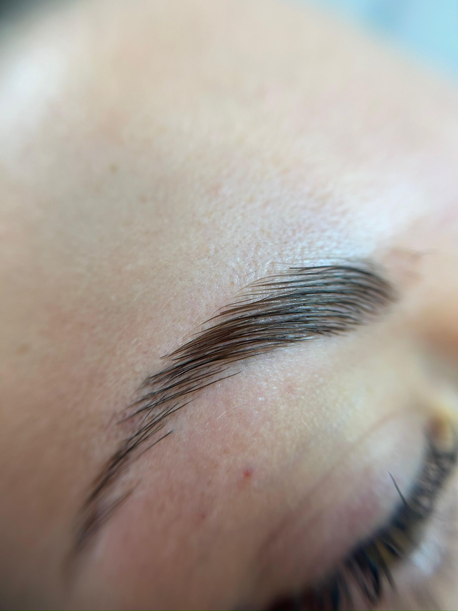 Ergebnis eines Browliftings